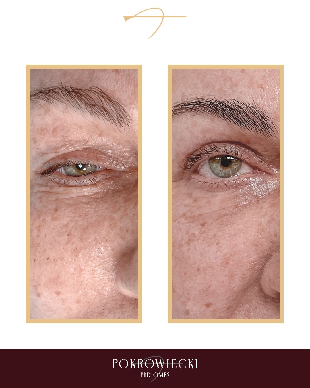 Rafał Pokrowiecki-7