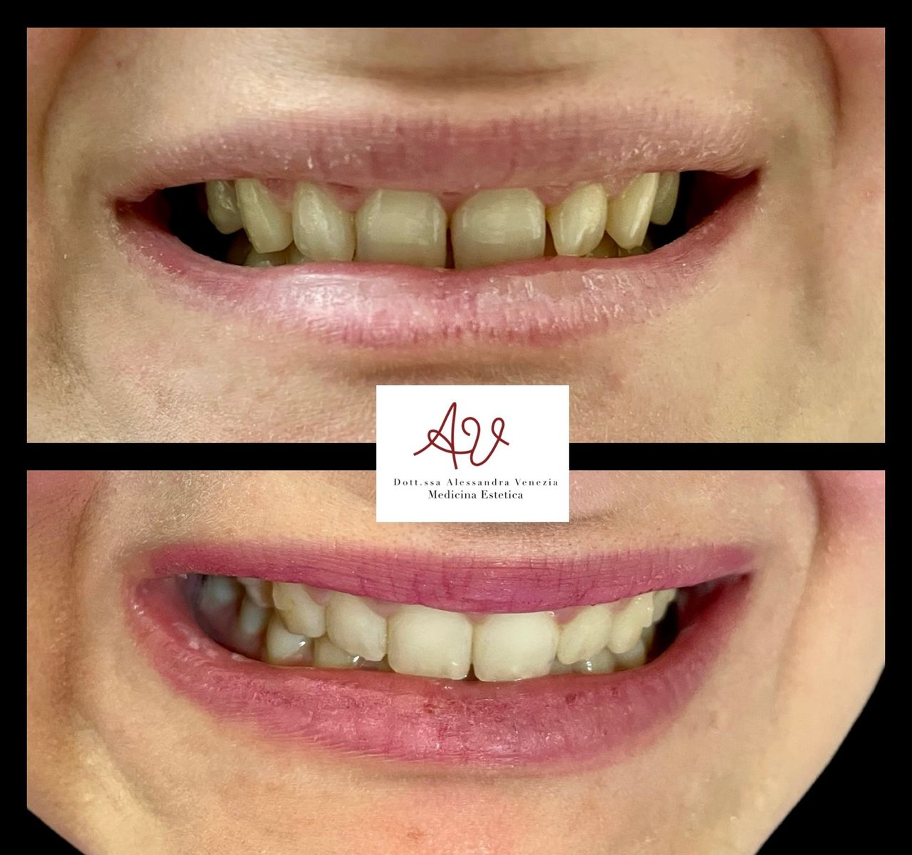 Alessandra Venezia-12