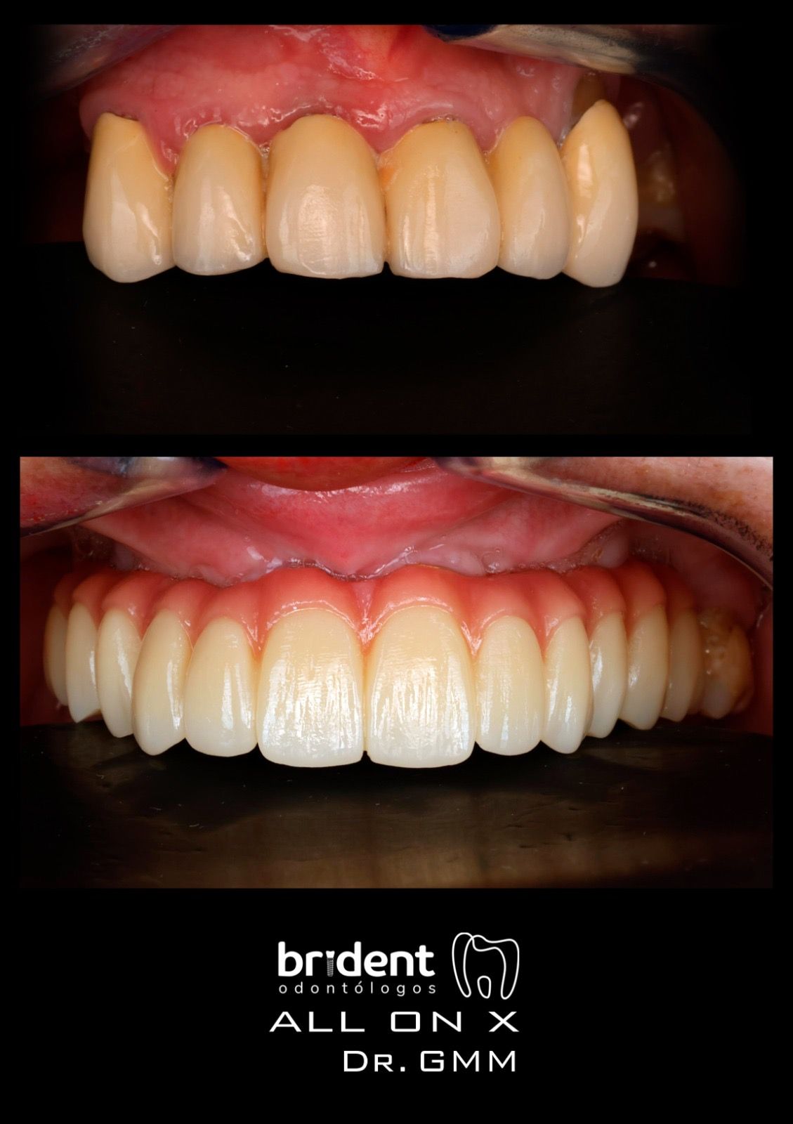 Guillermo Moreno Masiá-89