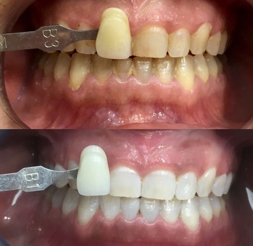 Carlos Carrascosa Milo-4