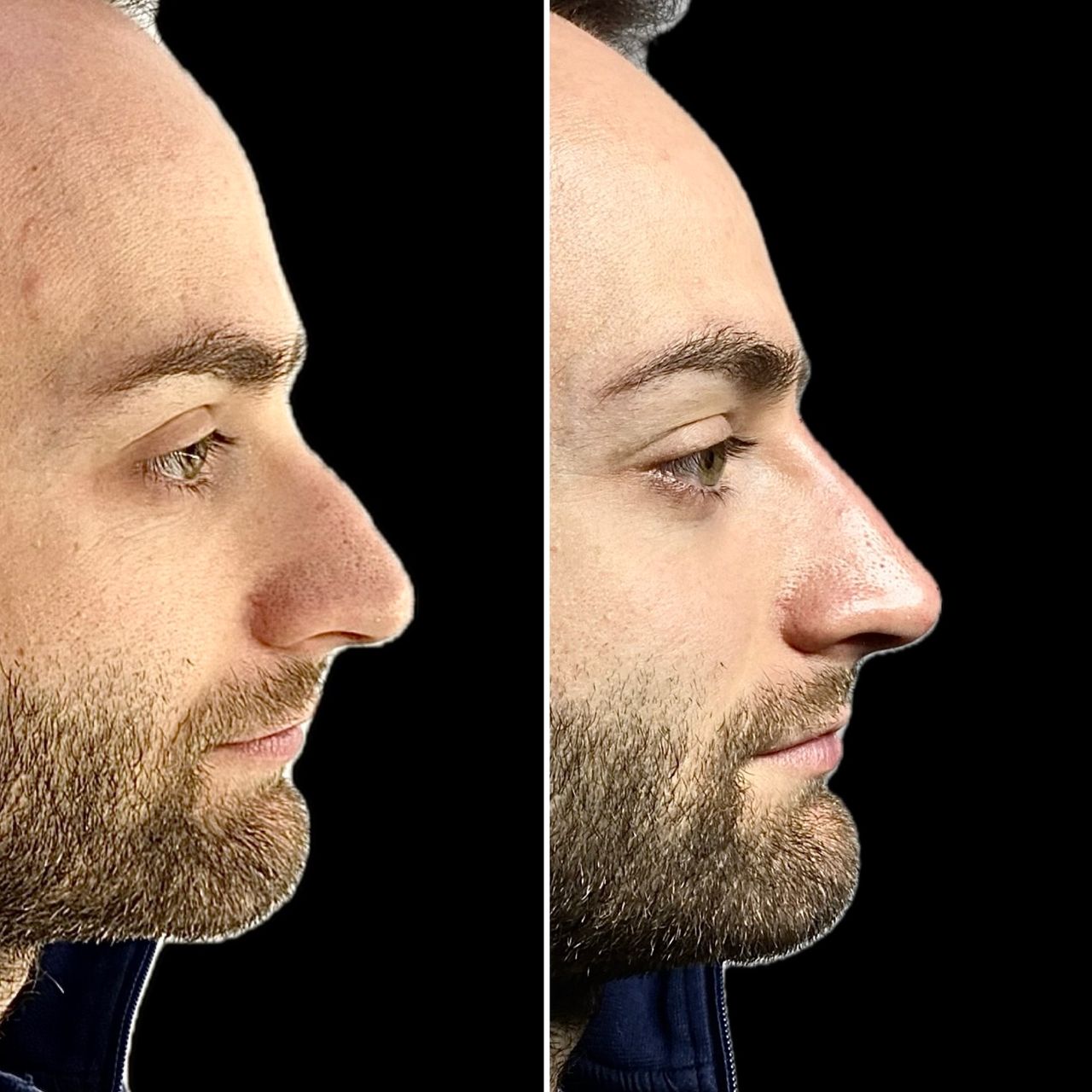 Valerio Lorenzano-10