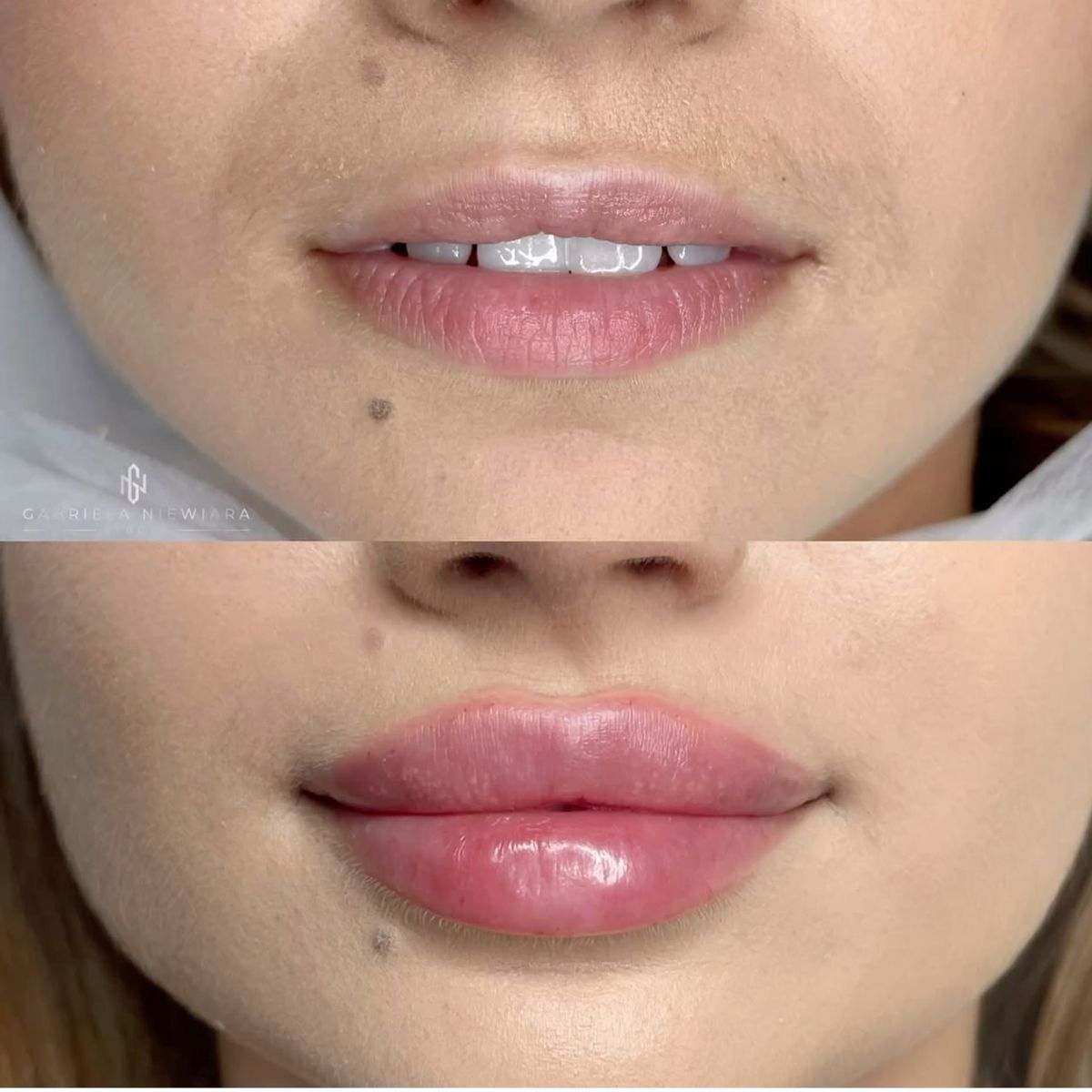 Angela Napolitano-14