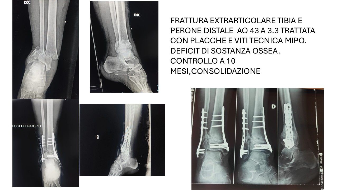 Bartolomeo D'amora-3