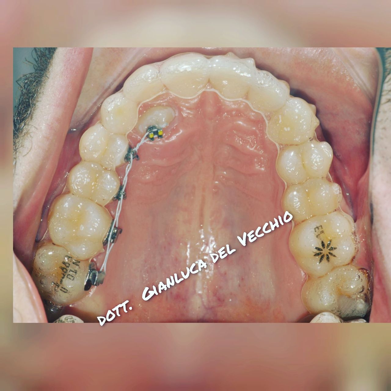 Gianluca Del Vecchio-78