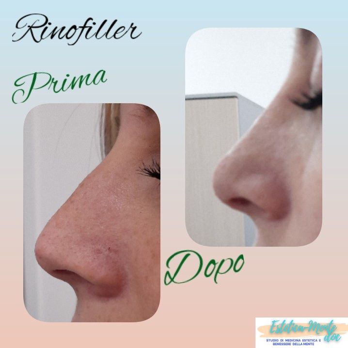 Paola Della Rocca-52