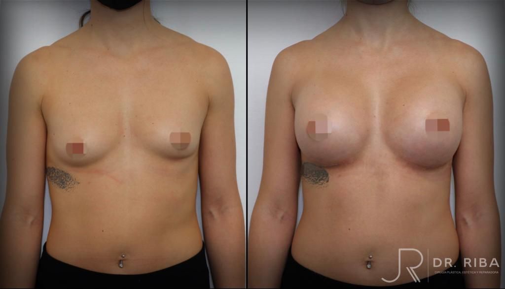 Jordi Riba Vilchez-36