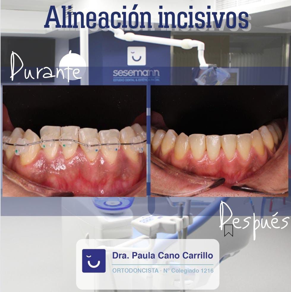 Paula Cano Carrillo-19