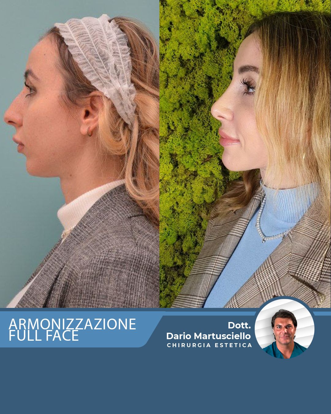 Dario Martusciello-30