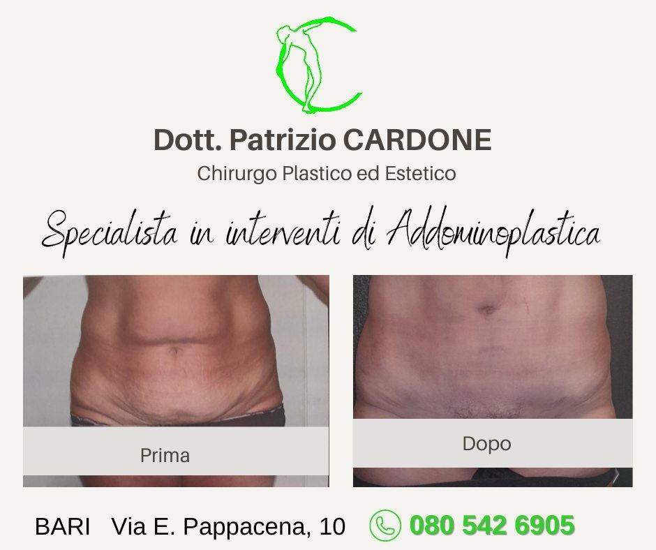 Patrizio Cardone-1