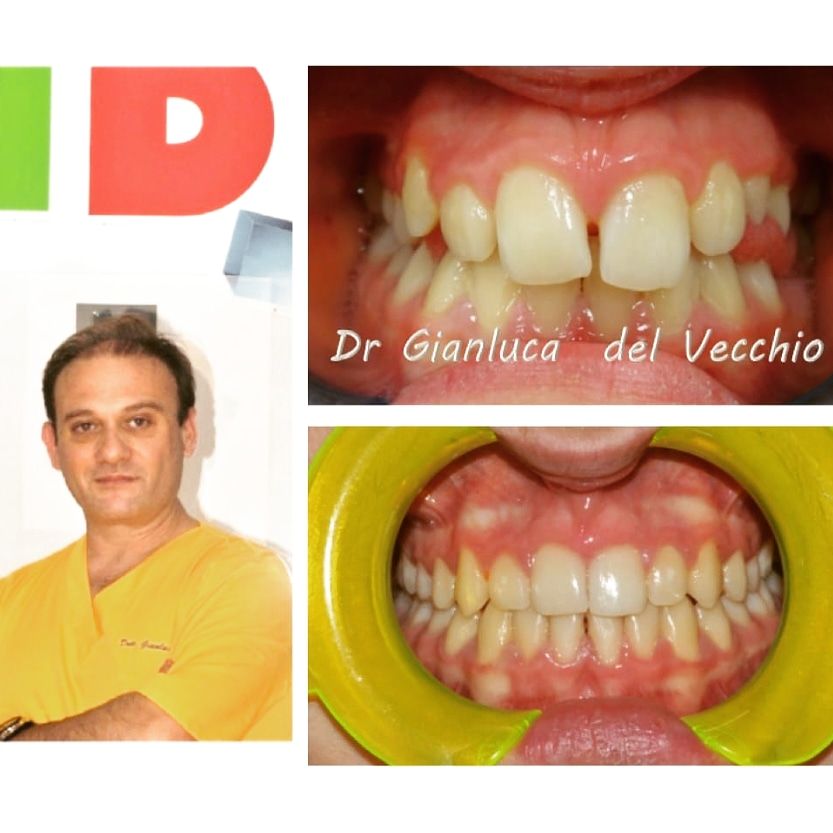 Gianluca Del Vecchio-88