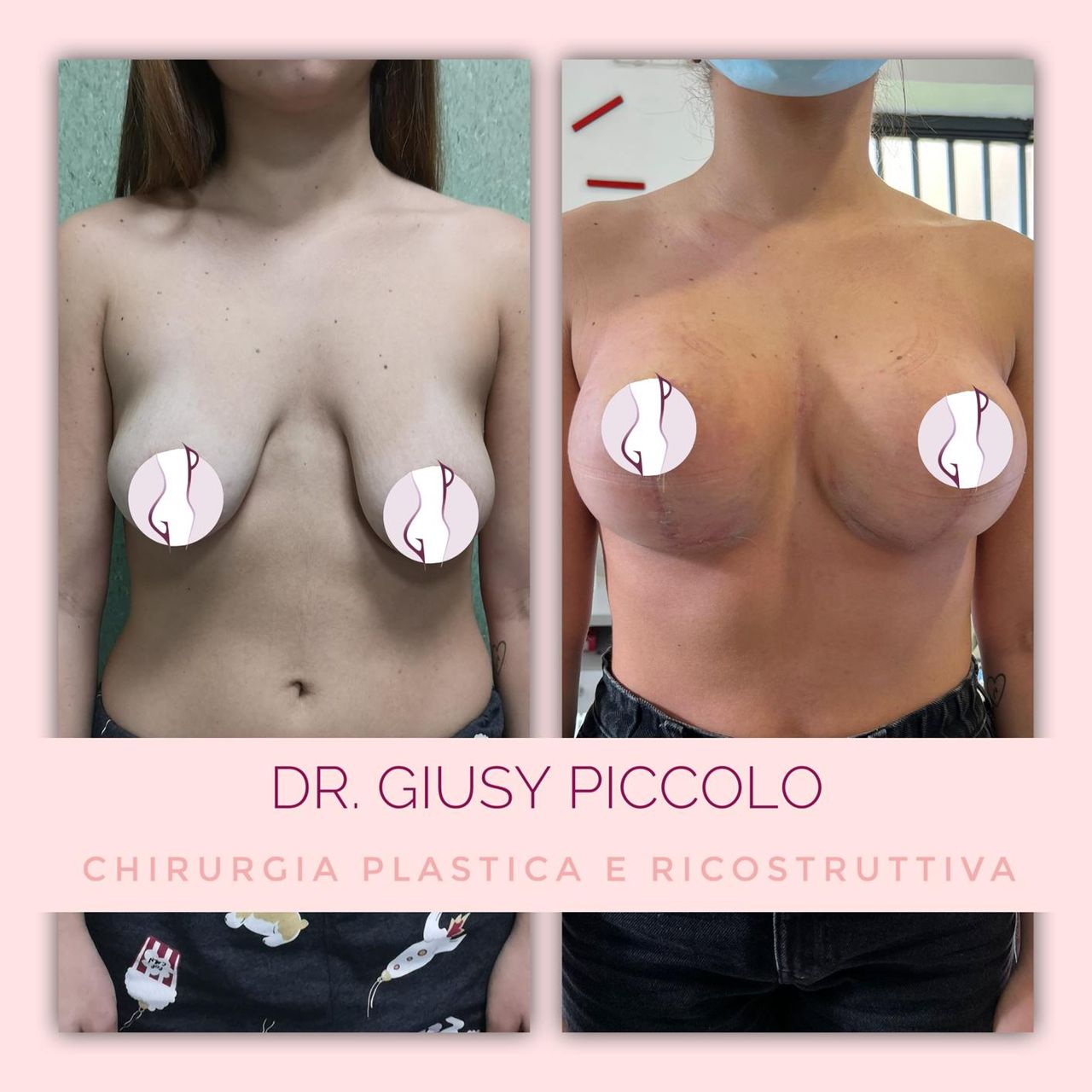 Giuseppina Piccolo-34