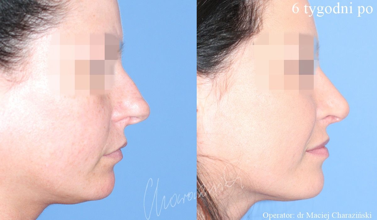 Maciej Charaziński-83