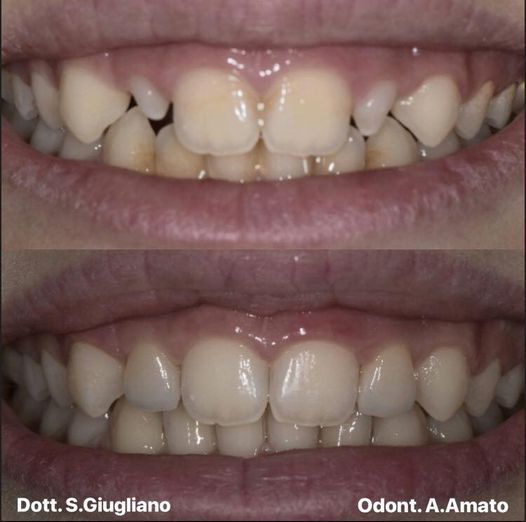 Saverio Giugliano-11