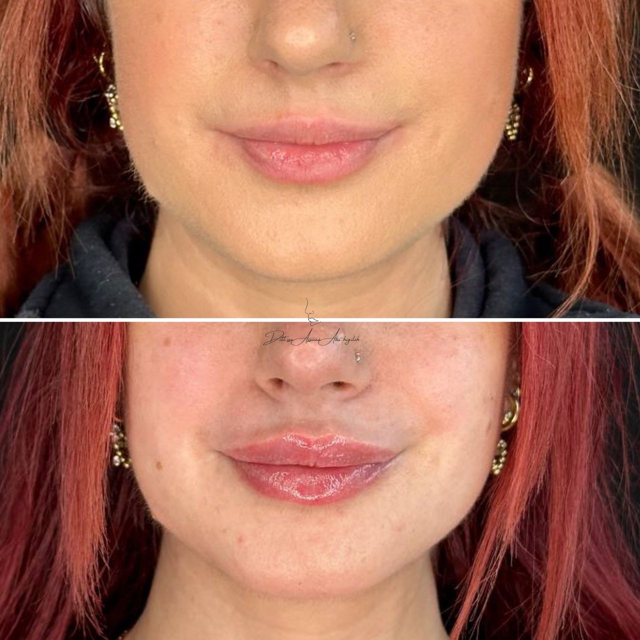 Assmaà Abu Higileh-11