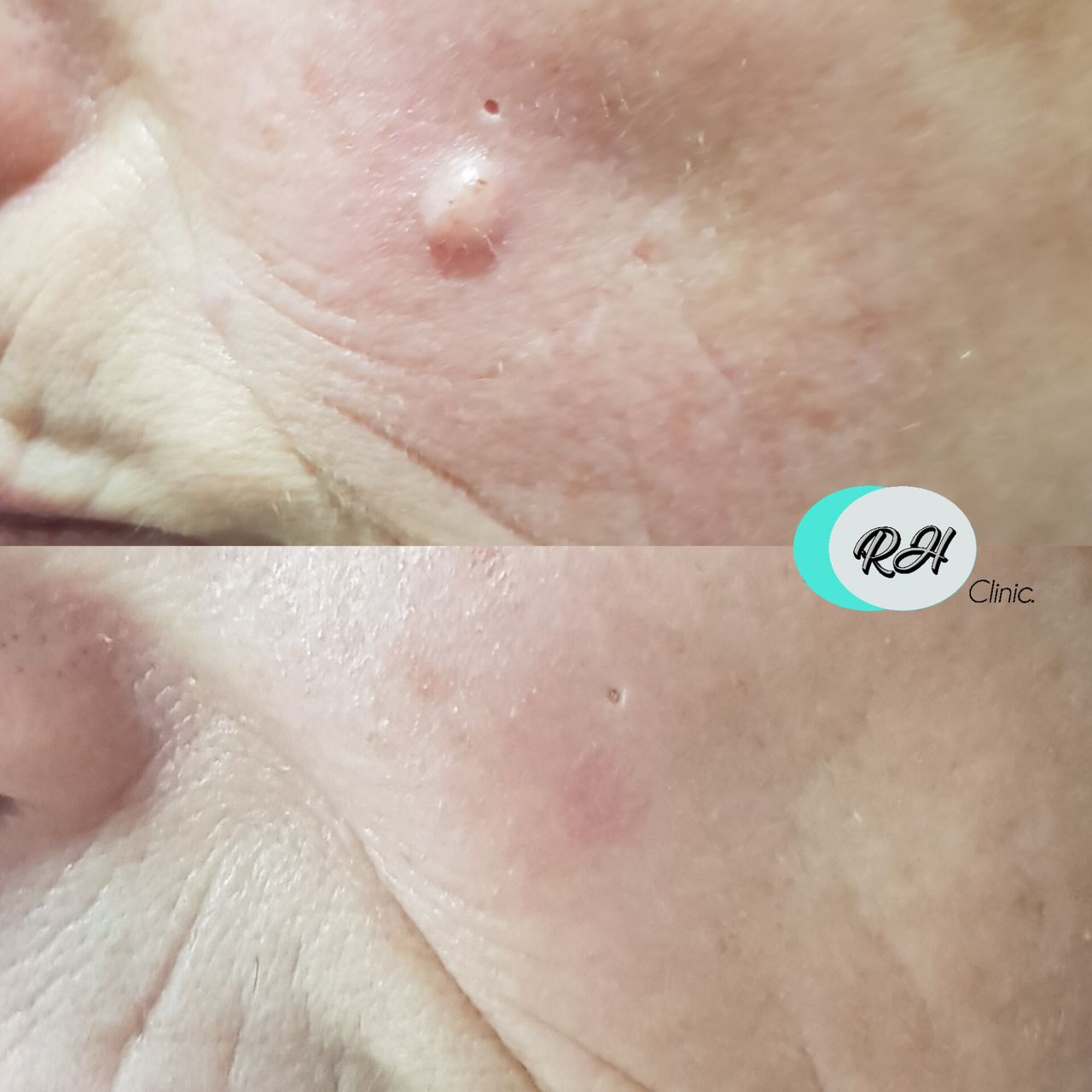 Rosalba Herrero Zerpa-596