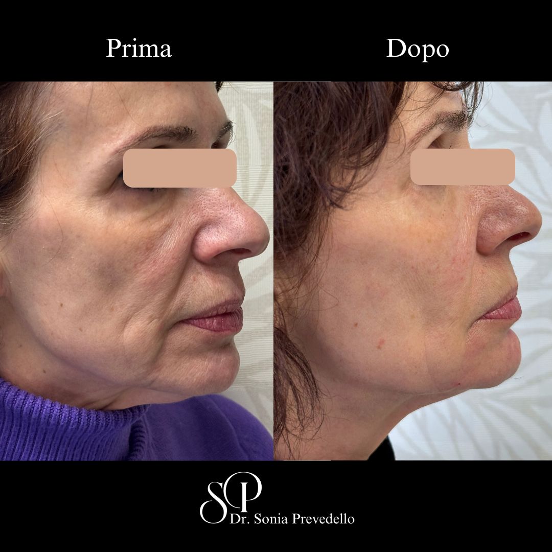 Sonia Prevedello-25