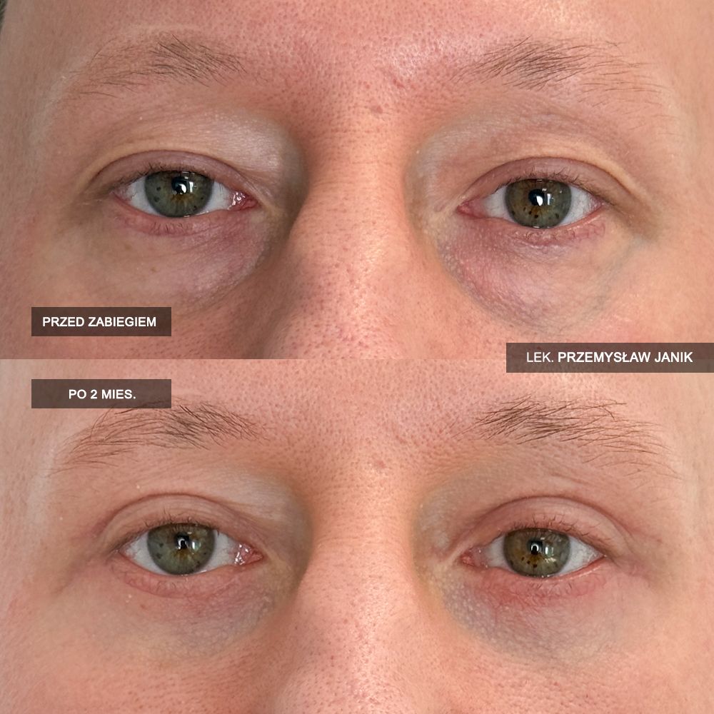 Przemysław Janik-65