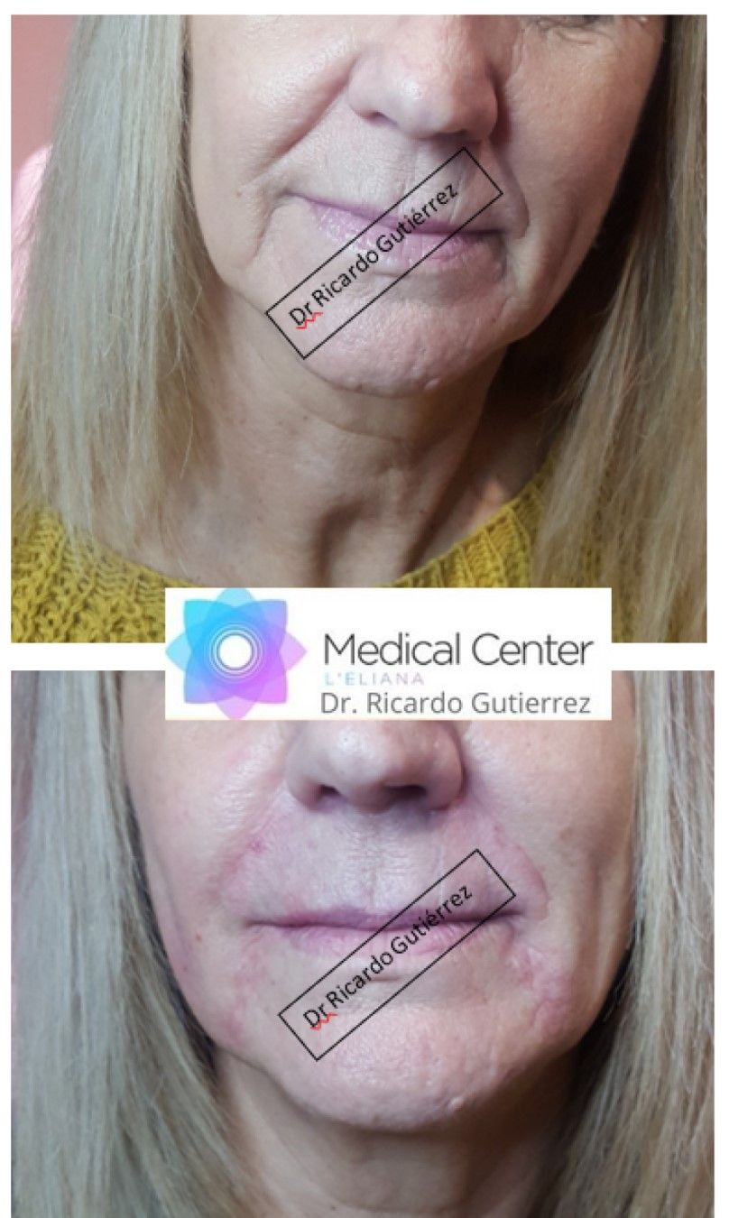 Ricardo Gutierrez Fayos-0