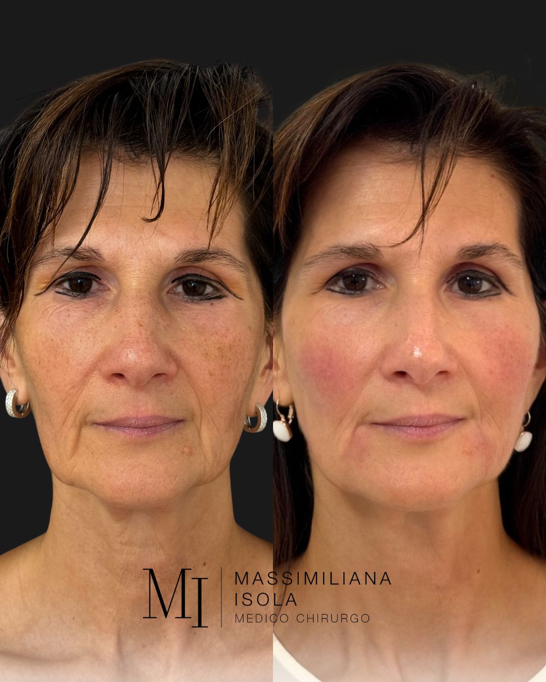 Massimiliana Isola-2