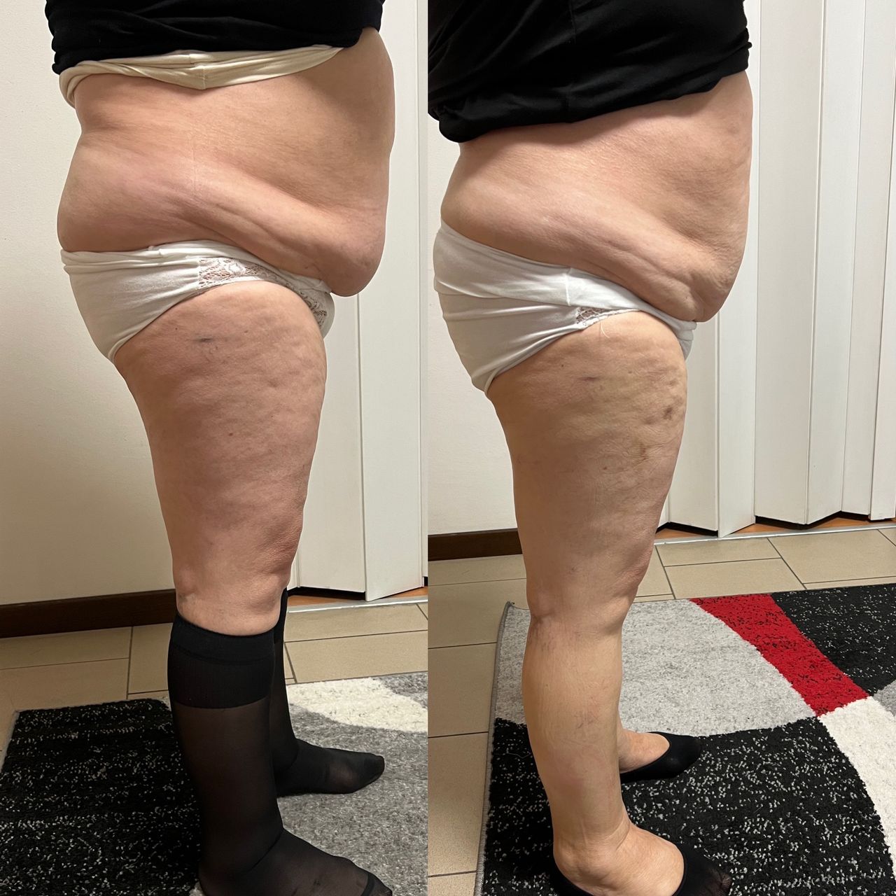 Jacopo Pettinelli-44