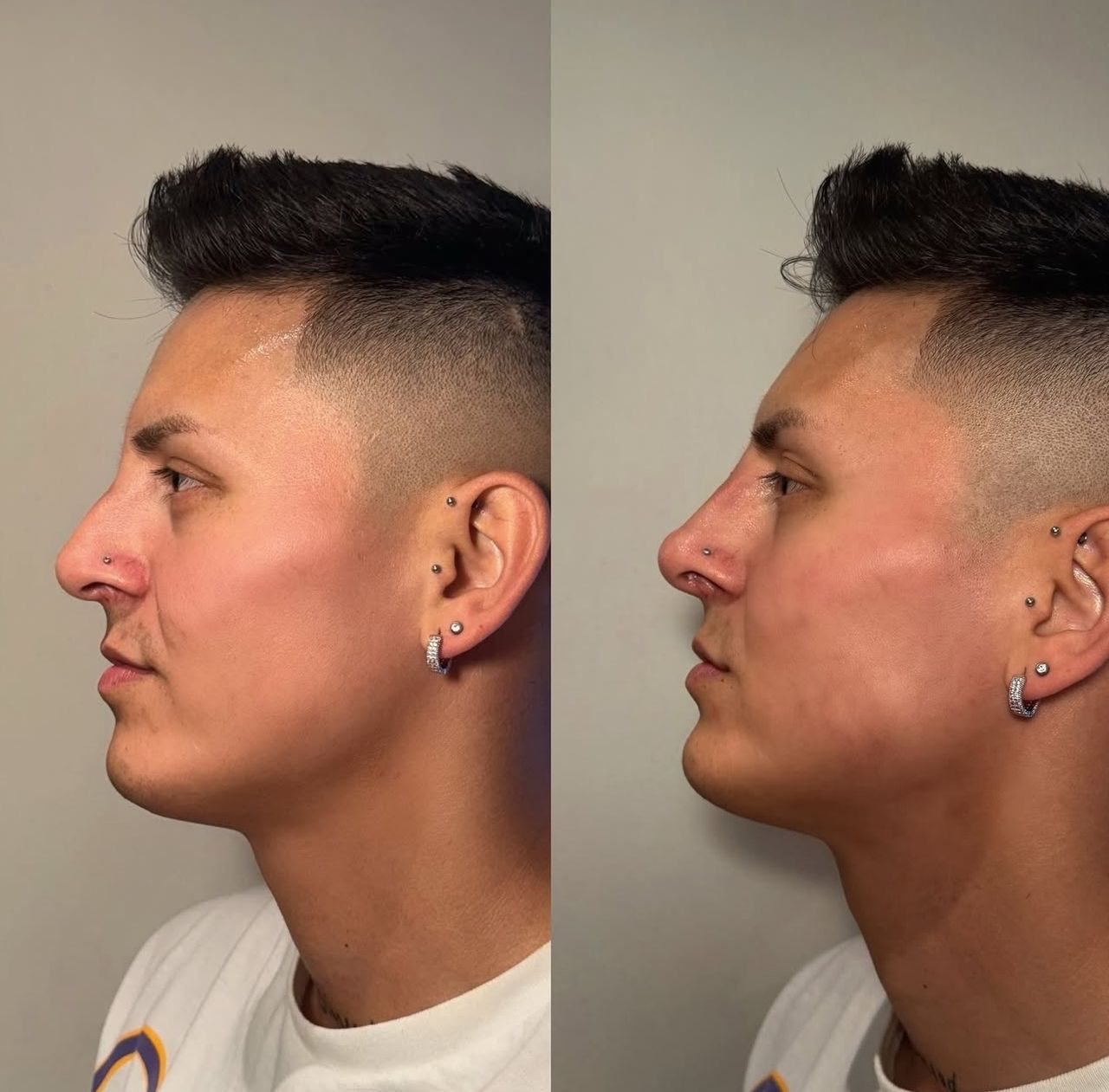 Andrea Catahysa Del Torto-8