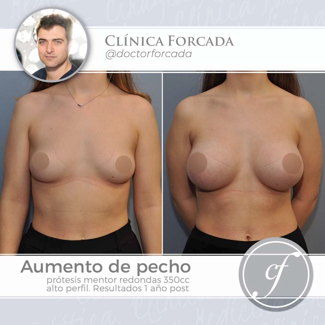 Eduardo Forcada Melero-10