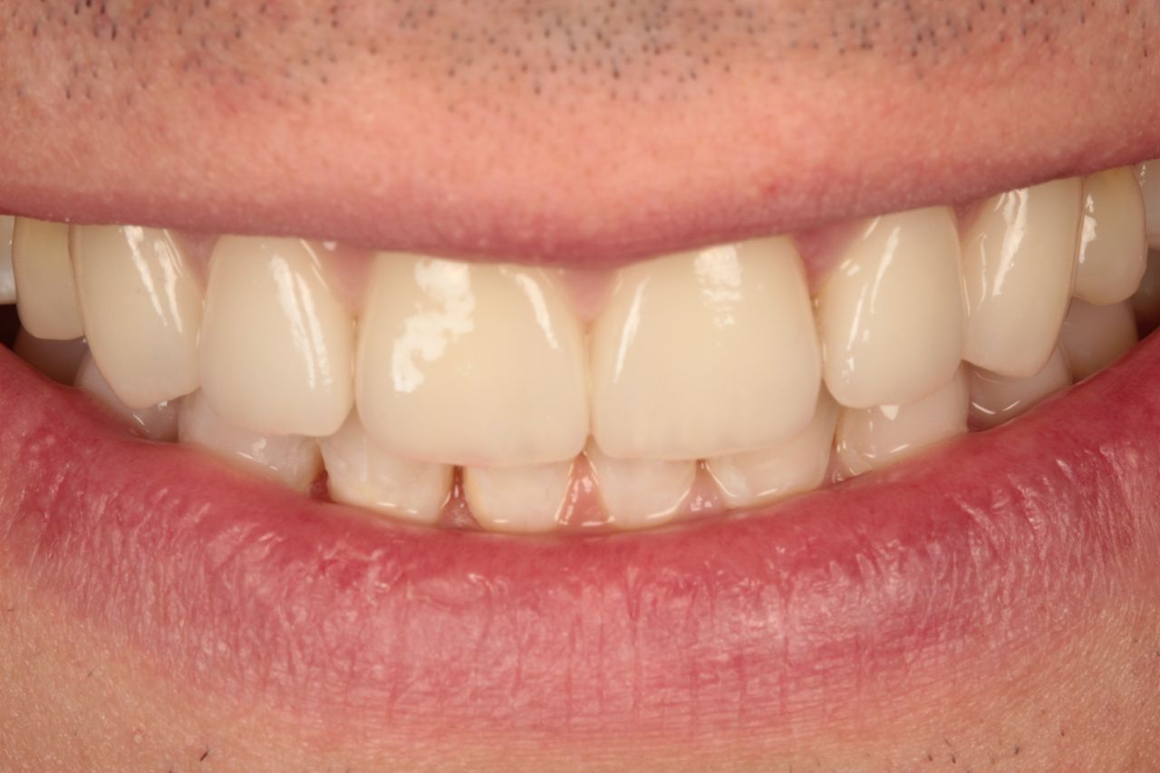 Elżbieta Zalewska-9