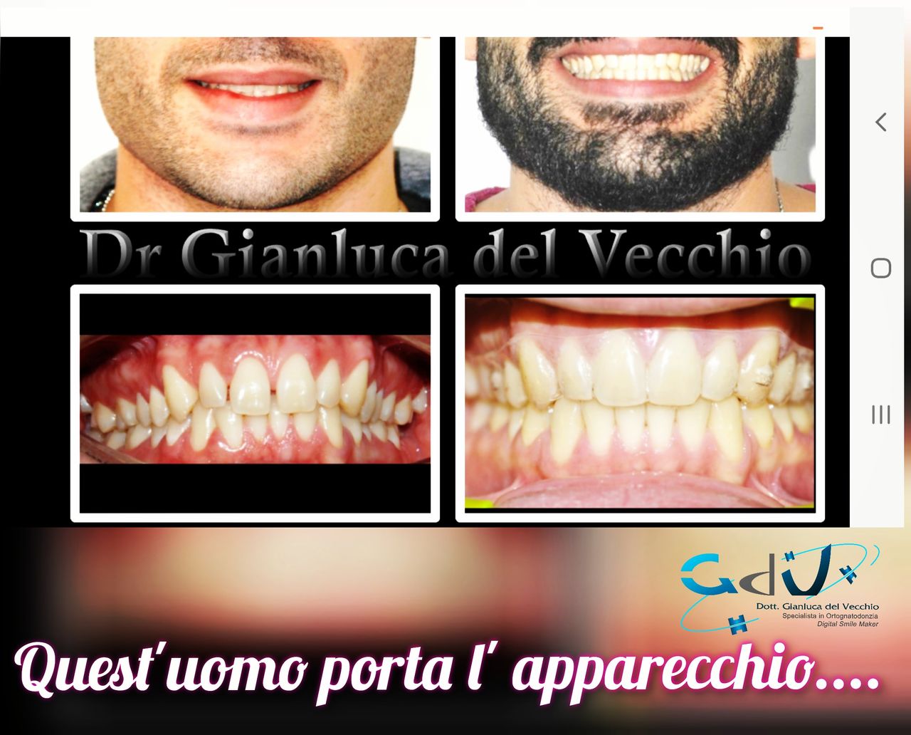 Gianluca Del Vecchio-98