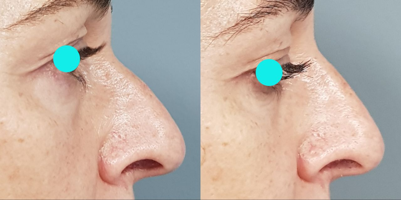 Rosalba Herrero Zerpa-4