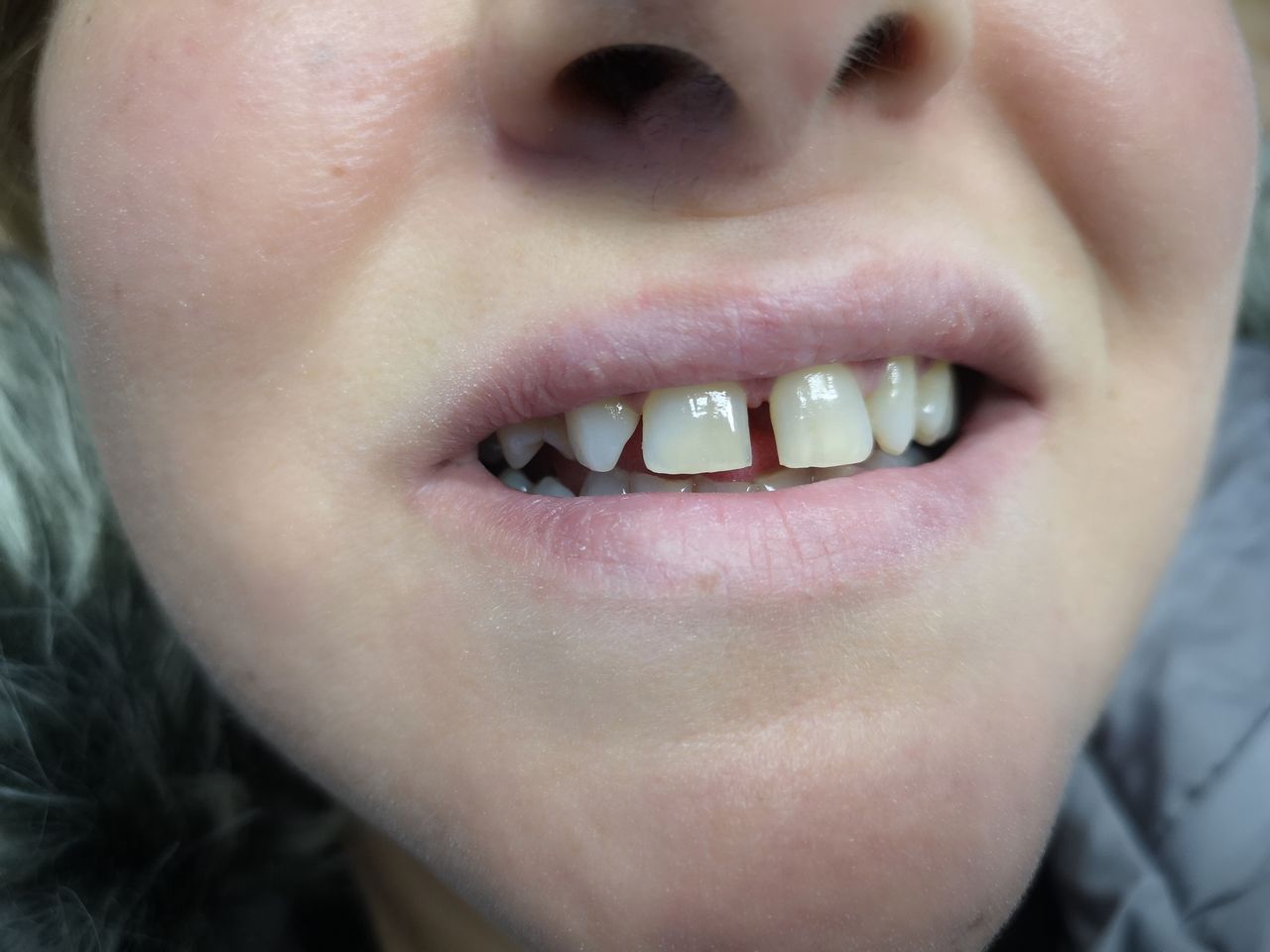 Stefano De Simone-131