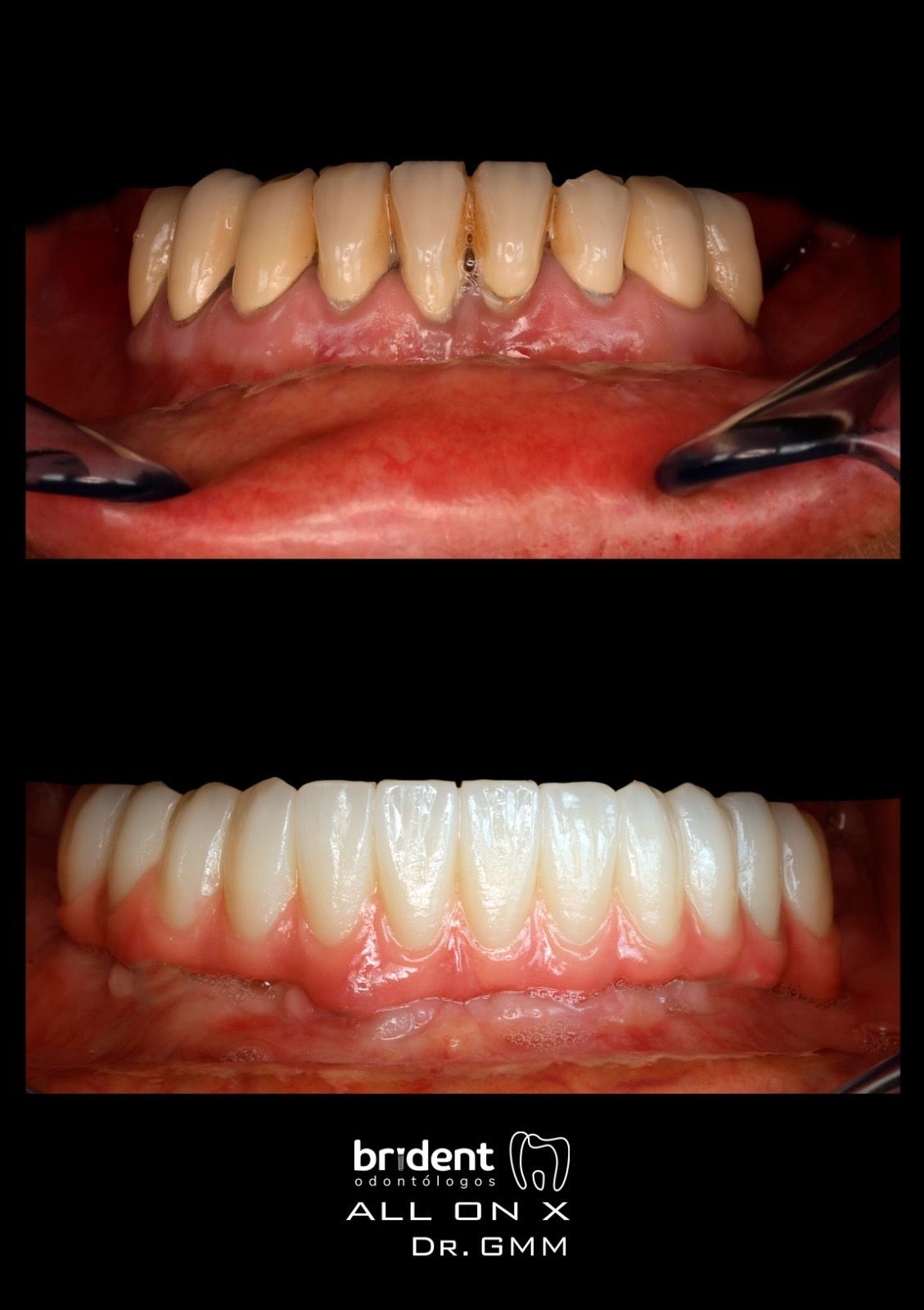 Guillermo Moreno Fragoso-69