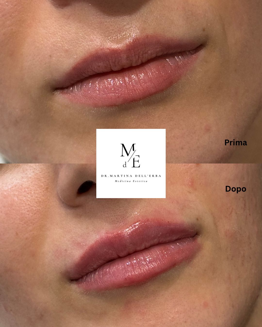 Martina Dell'erba-18