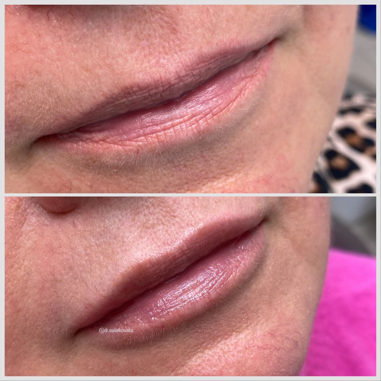 Angelika Świątkowska-43