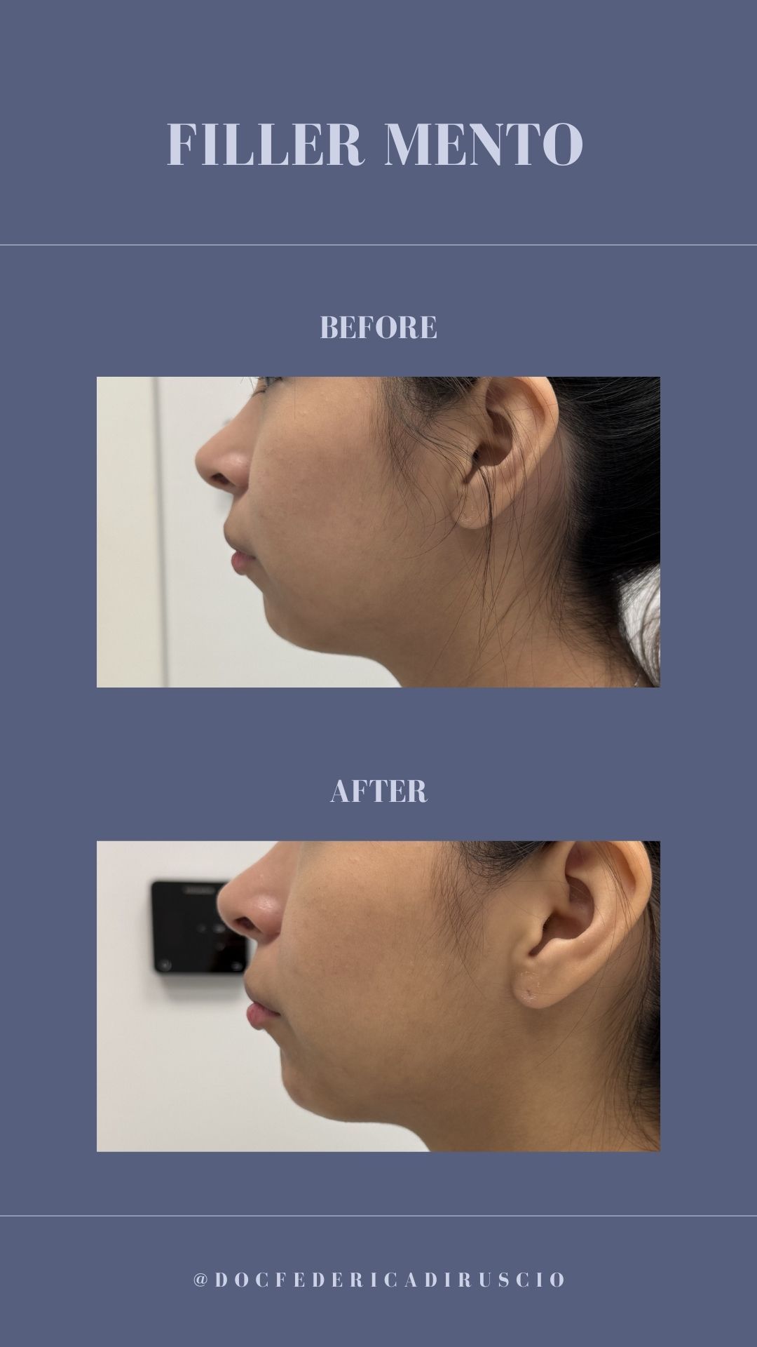 Federica Di Ruscio-16