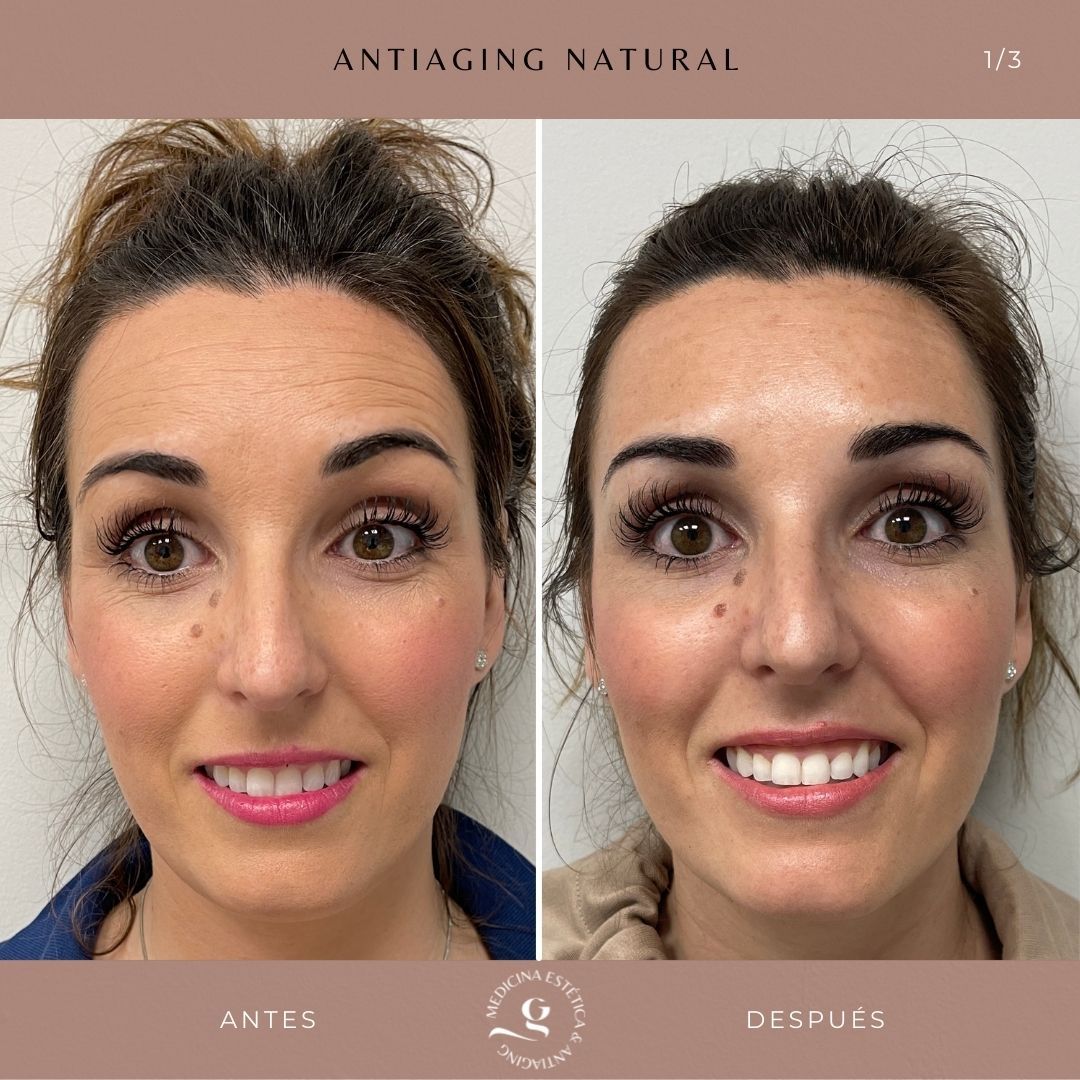 ​Giovanni Giorgianni-30