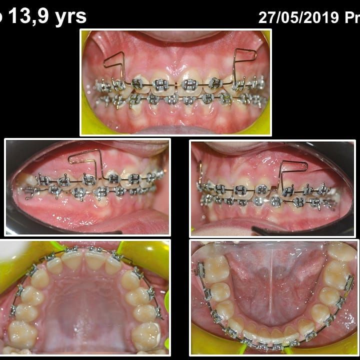 Gianluca Del Vecchio-49