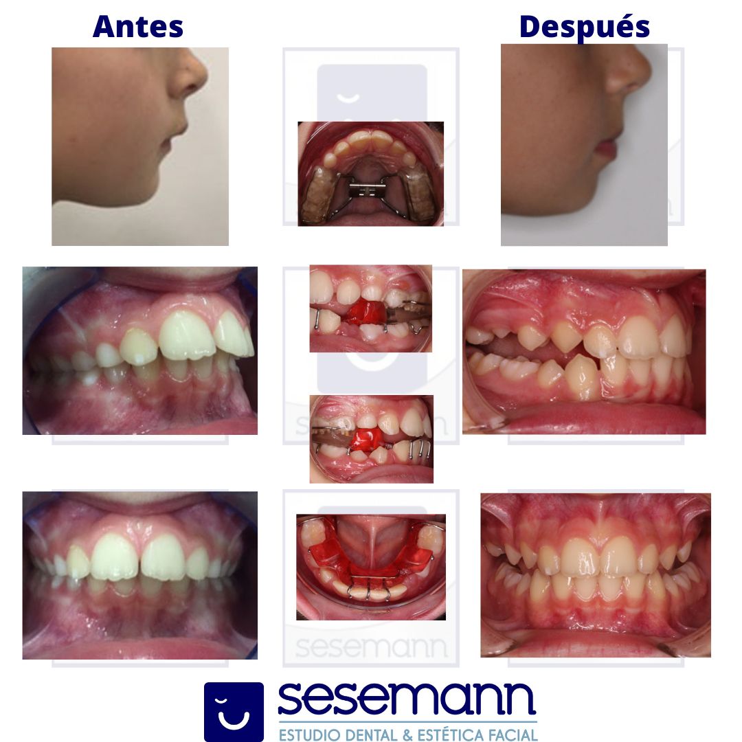 Paula Cano Carrillo-108