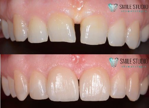 Michał Jankowski-22