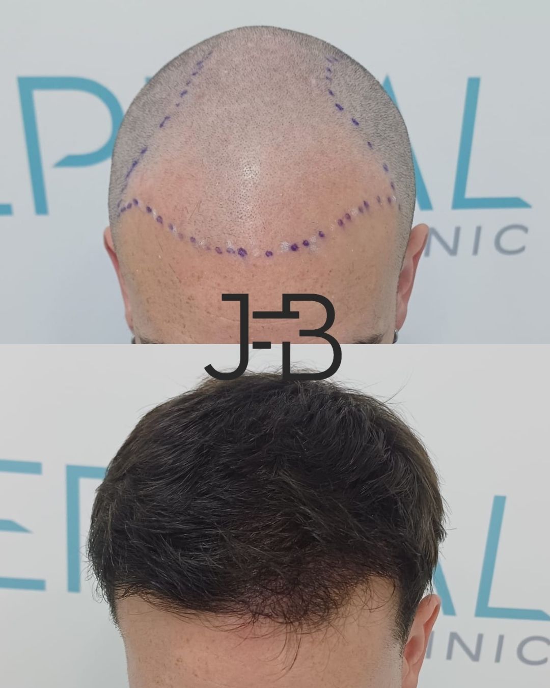 Juan Francisco Belén Montero-4