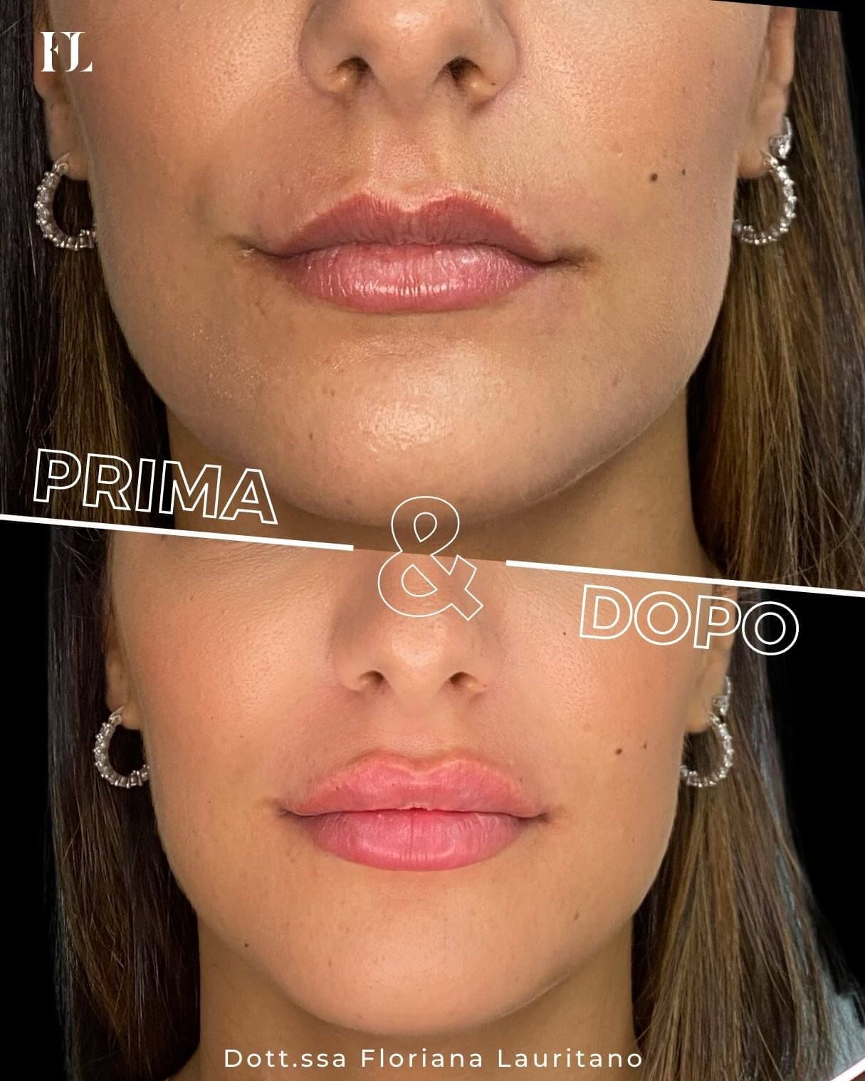 Floriana Lauritano-12