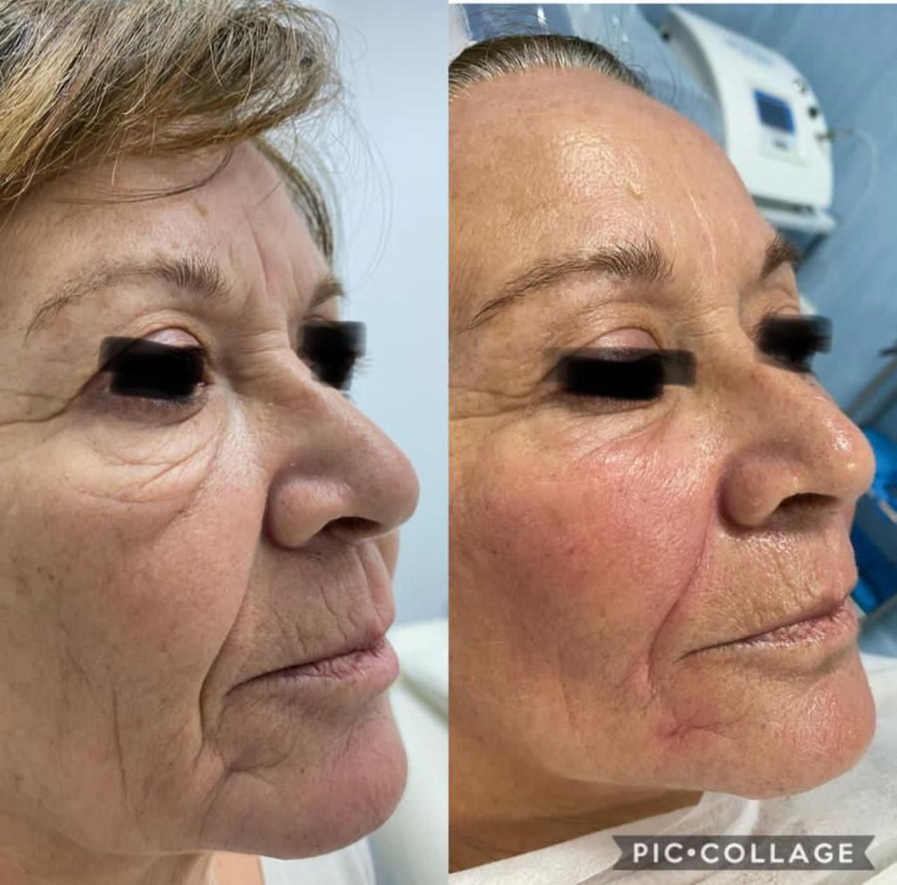 Angela Napolitano-11