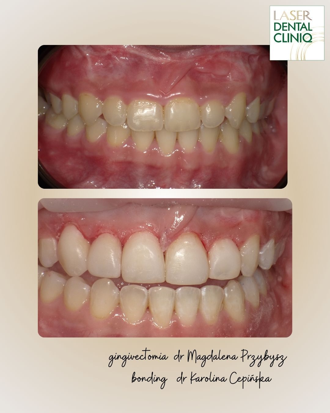 Magdalena Przybysz-37