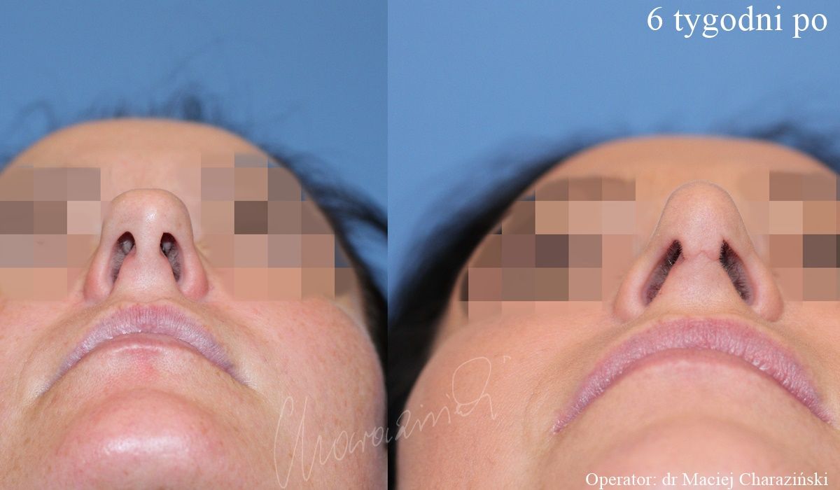 Maciej Charaziński-84