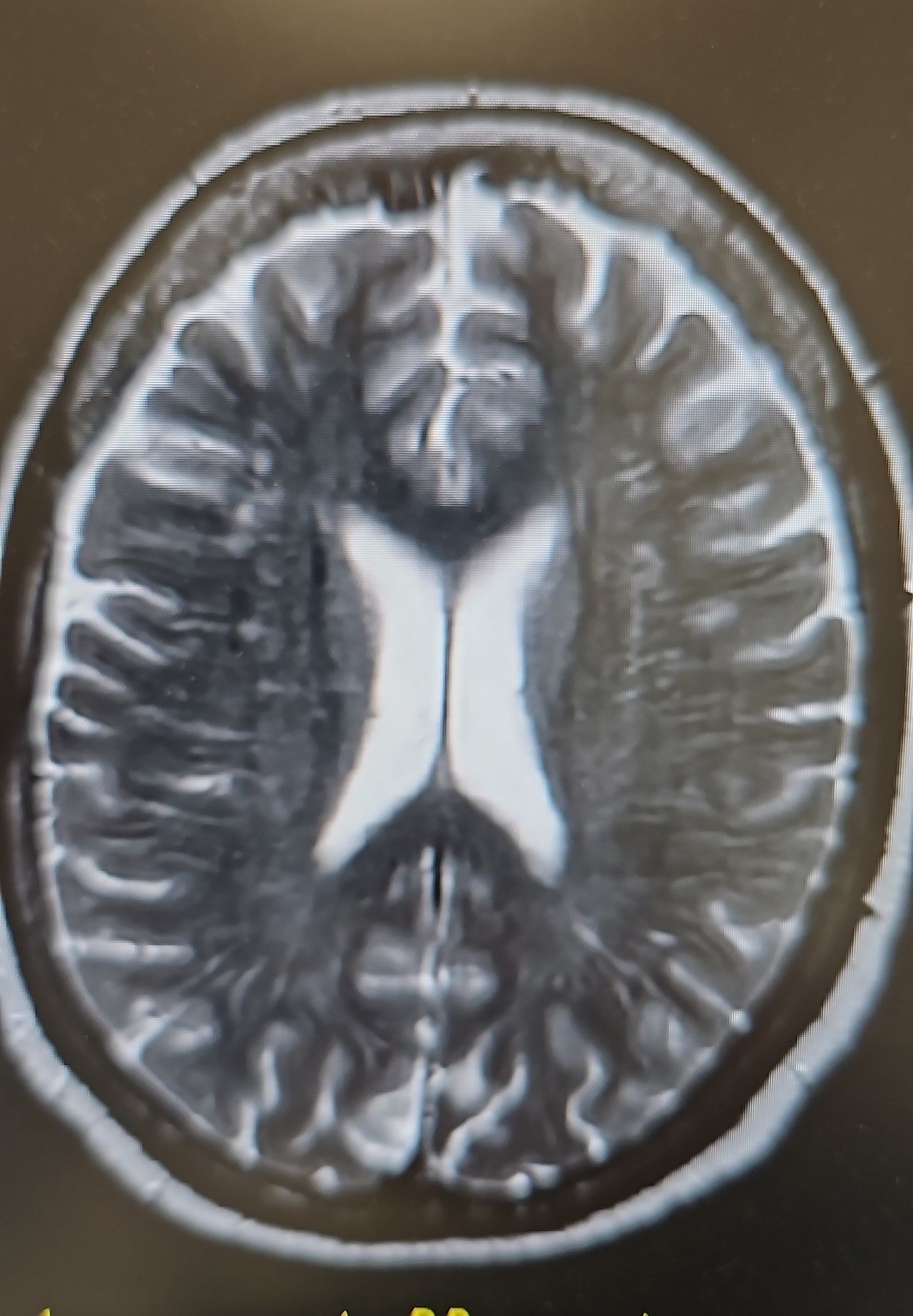 Stefania De Trane-18