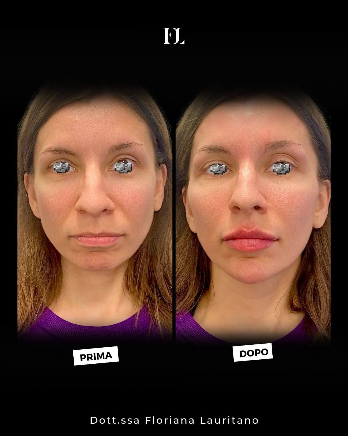 Floriana Lauritano-39