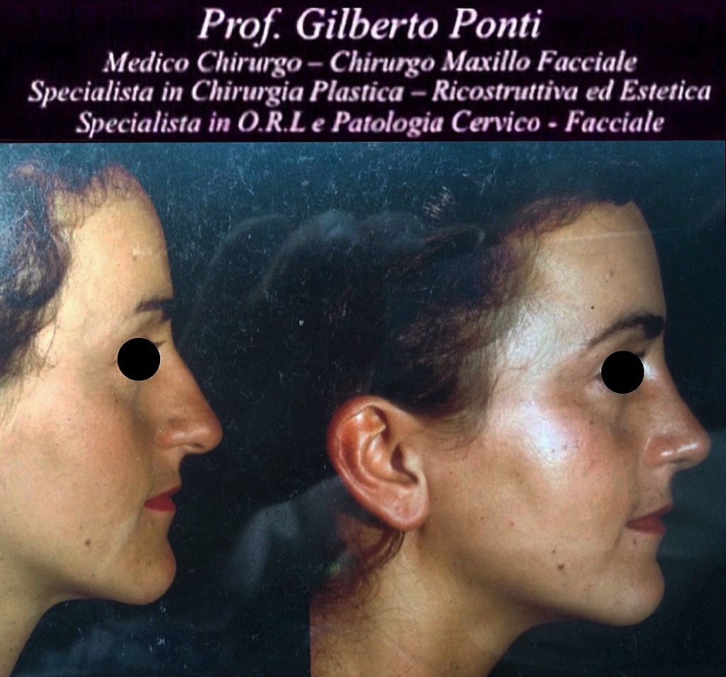 Gilberto Ponti-13