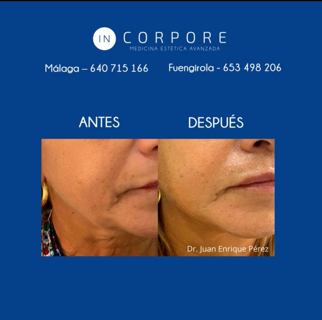 Juan Enrique Pérez Enríquez-88