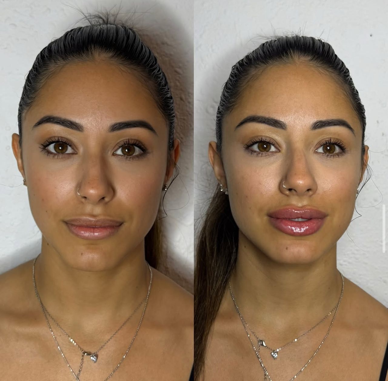 Andrea Catahysa Del Torto-5