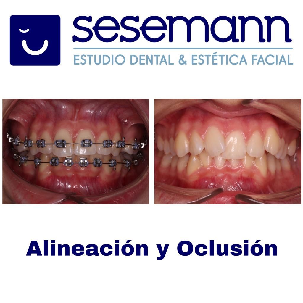 Paula Cano Carrillo-120