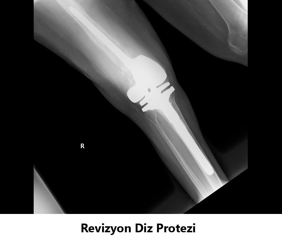 Javid M. Azarabadı-10